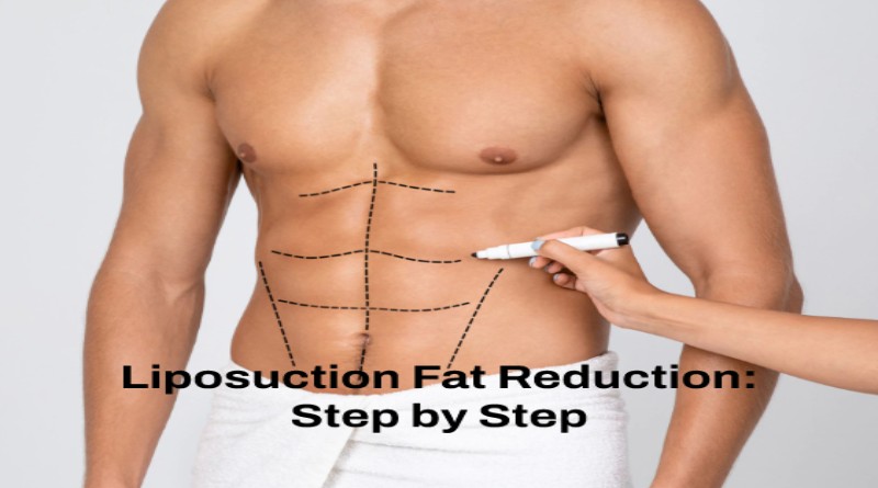 Liposuction Fat Reduction Step by Step