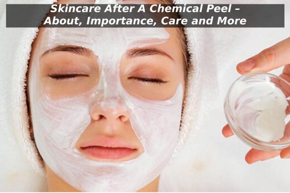 Skincare After A Chemical Peel – About, Importance, Care and More