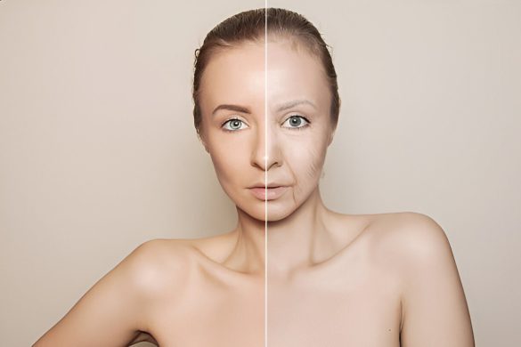 How To Reduce Melanin In The Skin