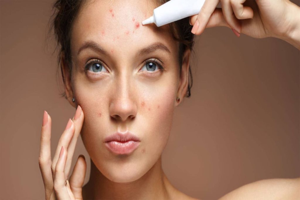 Treatment For Acne Problem: What Actually Works 2026 Guide